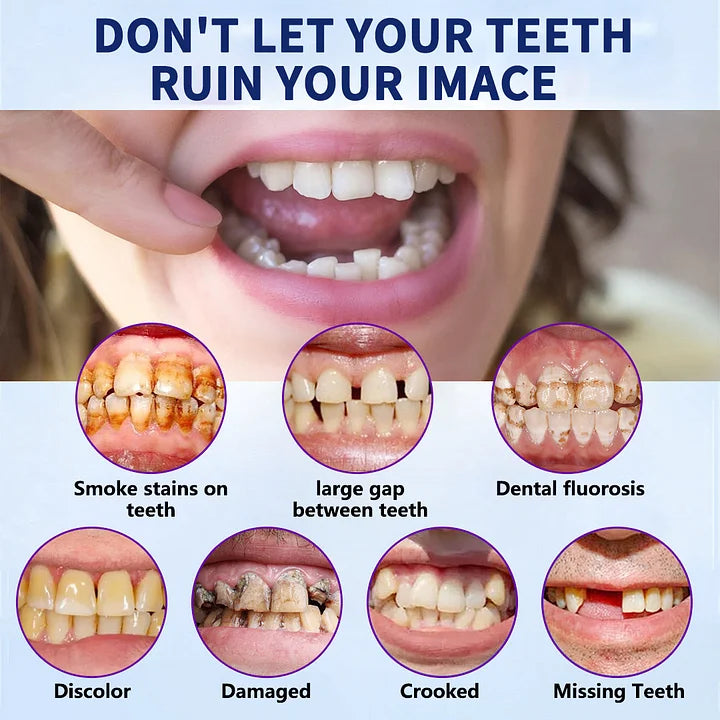 TREVONX™ - 🦷Avancerat Anpassat Fullständigt Tandprotes-set🦷 (⏰Tidsbegränsad rabatt ⏰)