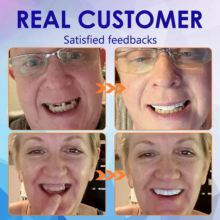 TREVONX™ - 🦷Avancerat Anpassat Fullständigt Tandprotes-set🦷 (⏰Tidsbegränsad rabatt ⏰)